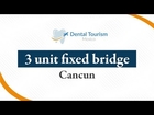 3 Unit Bridge Cancun